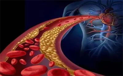 Lower blood fat